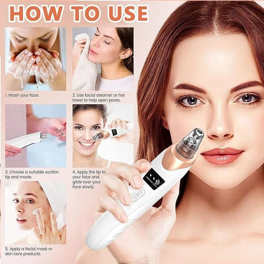 Professional Electric Blackhead Remover Vacuum - The HC Store