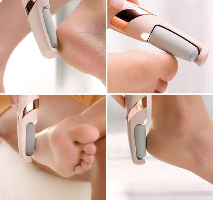 Electric Foot Callus Remover - Professional Rechargeable Pedicure Tool for Dead Skin & Cracked Heels