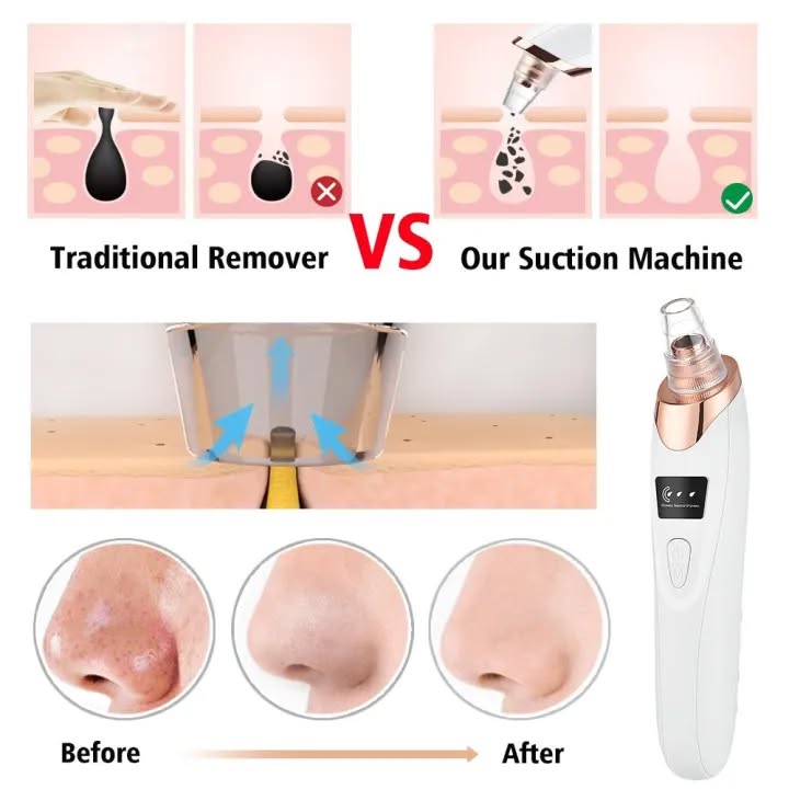 Professional Electric Blackhead Remover Vacuum - The HC Store